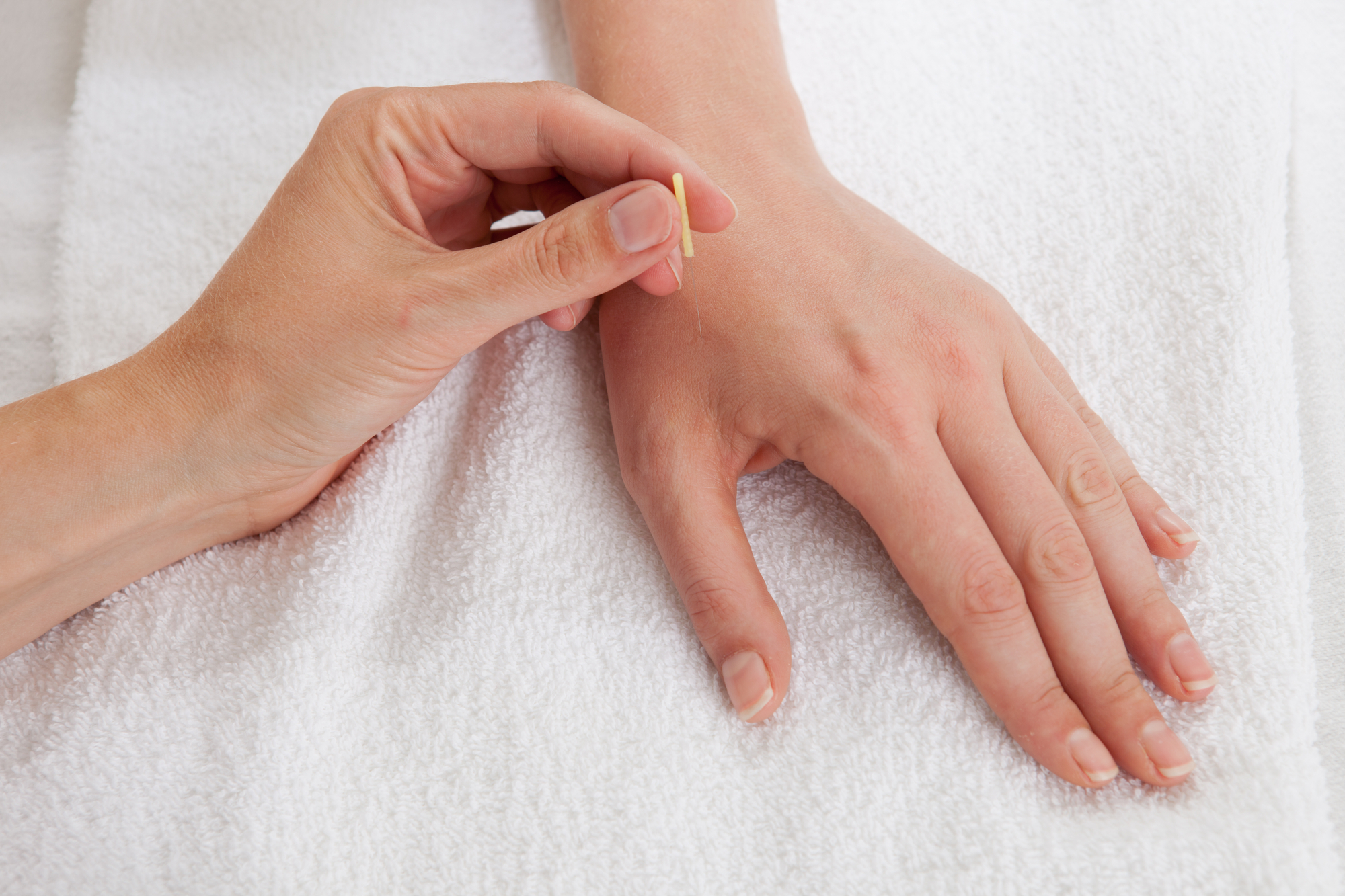10 Things You Should Expect from your First Acupuncture Appointment